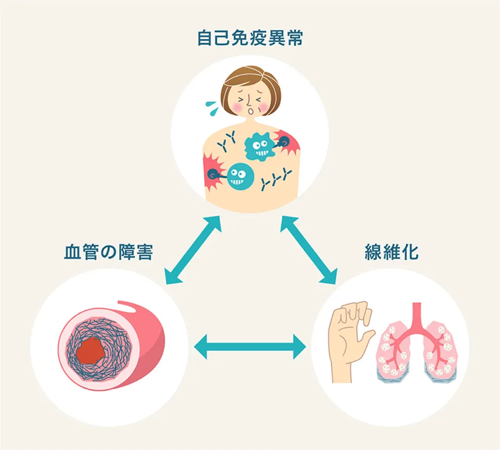 全身性強皮症ってどんな病気？ | わかる、つながる、強皮症