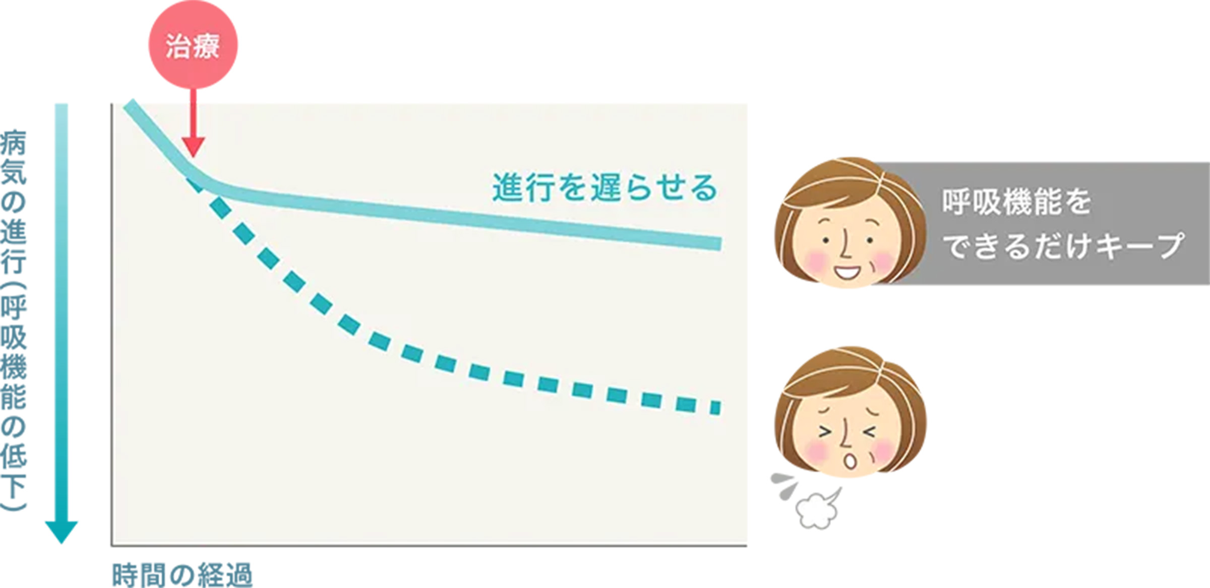 どんな治療があるの？ | わかる、つながる、強皮症